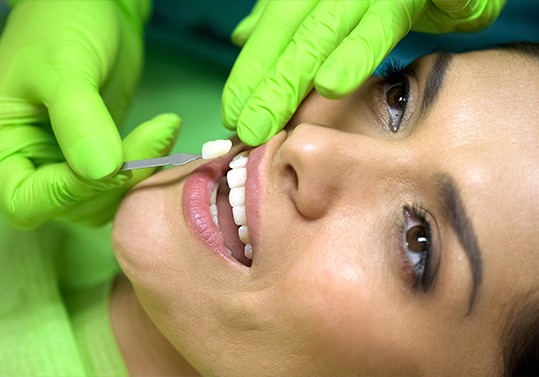 Cosmetic dentist placing a dental veneer over a patient's tooth