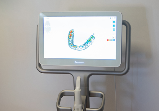 Digital dental impressions of teeth on computer monitor