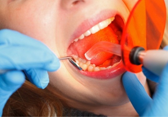 Close up of dental patient getting cosmetic dental bonding