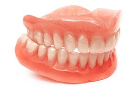 Illustration of implant dentures for lower arch