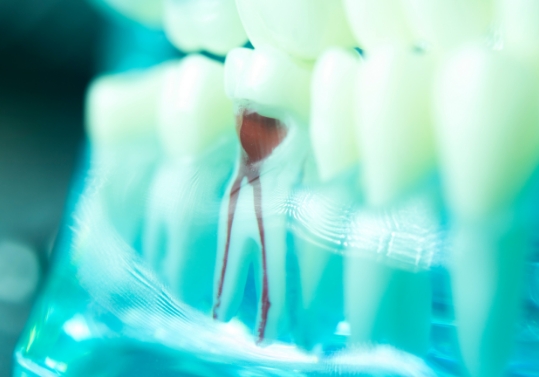 Model of tooth showing the nerves and root canals
